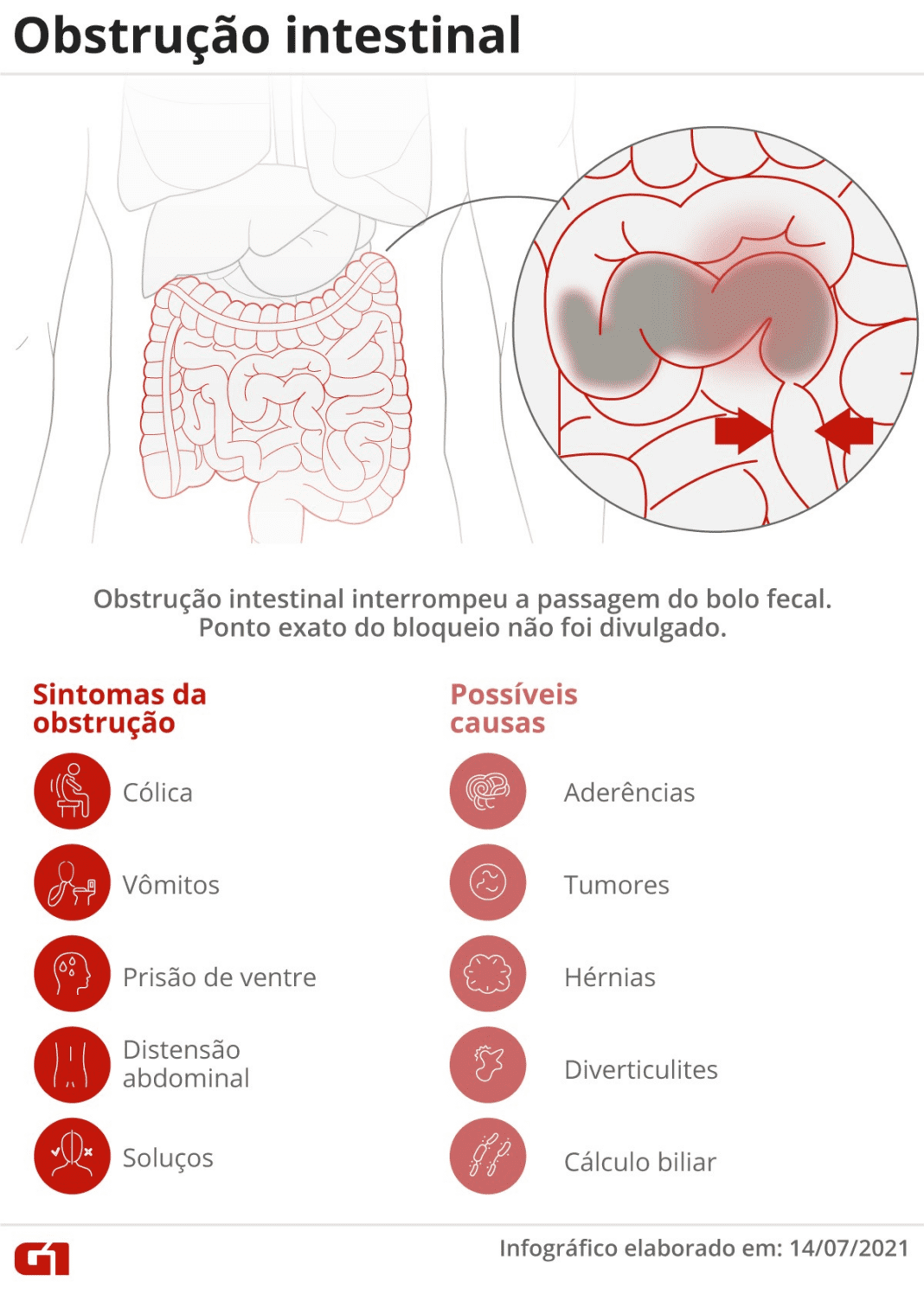 Bolsonaro fala em 'dores intensas' no abdômen e diz que provavelmente passará por nova cirurgia
