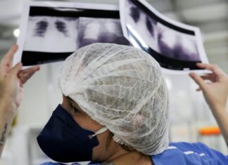 Diagnóstico tardio dá poucas chances de cura do câncer de pulmão