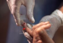 SUS começa a usar novo tratamento contra a malária em crianças