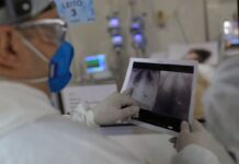 Broncopneumonia: entenda quadro que causou internação de Bolsonaro