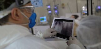 Broncopneumonia: entenda quadro que causou internação de Bolsonaro