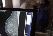 Plano de saúde terá que cobrir mamografia digital para todas as idades