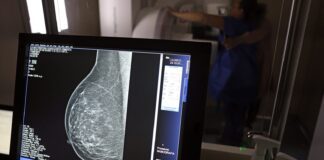 Plano de saúde terá que cobrir mamografia digital para todas as idades