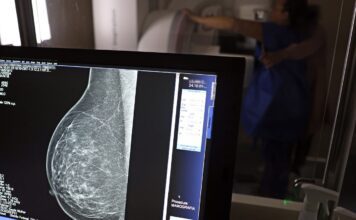 Entidades alertam médicos sobre pedidos de mamografia digital