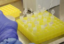 SP confirma segundo caso importado de sarampo