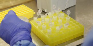 SP confirma segundo caso importado de sarampo