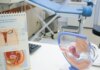 Uma em cada dez brasileiras sofre de endometriose