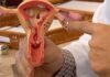 Aberta chamada pública para pesquisas sobre endometriose