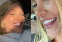 Joia nos dentes: dentista alerta sobre risco de tendência entre influencers