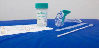 SUS detecta quase 10 mil testes positivos para HPV de alto risco