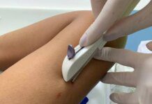 Implanon Passa A Ter Eficácia De Cinco Anos Após Decisão Da Anvisa